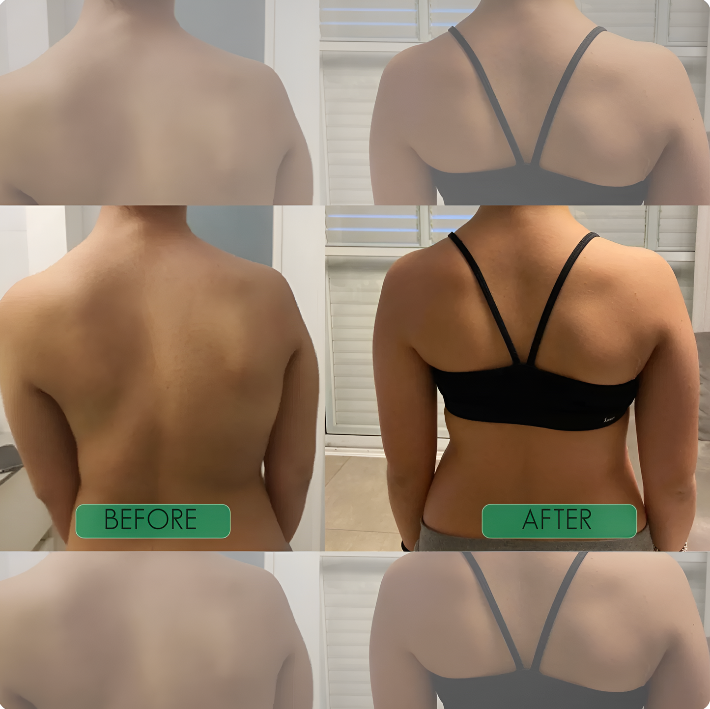Slekova™ - Instant Posture Corrector