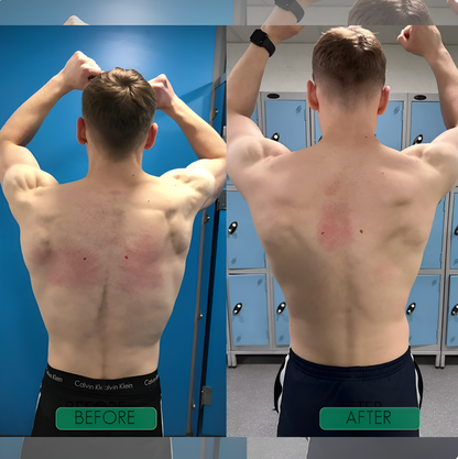 Slekova™ - Instant Posture Corrector